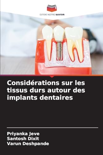 Considérations sur les tissus durs autour des implants dentaires von Editions Notre Savoir