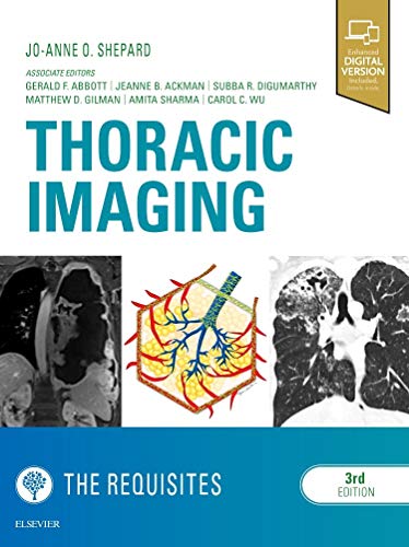 Thoracic Imaging The Requisites: Enhanced Digital Version Included. Details inside (Requisites in Radiology)