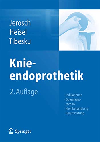 Knieendoprothetik: Indikationen, Operationstechnik, Nachbehandlung, Begutachtung von Springer