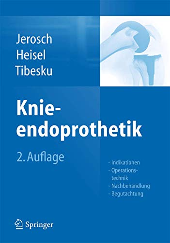 Knieendoprothetik: Indikationen, Operationstechnik, Nachbehandlung, Begutachtung