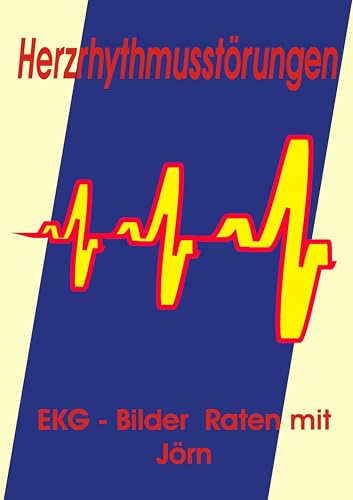 Herzrhythmusstörungen: EKG - Bilder Raten mit Jörn von Books on Demand GmbH