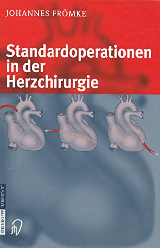 Standardoperationen in der Herzchirurgie von Springer