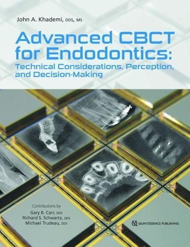 Advanced CBCT for Endodontics: Technical Considerations, Perception, and Decision-Making von Quintessence Publishing