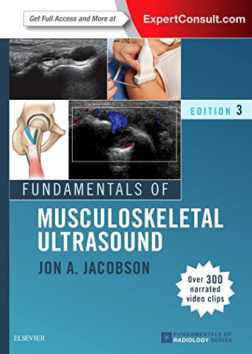 Fundamentals of Musculoskeletal Ultrasound (Fundamentals of Radiology) von Elsevier