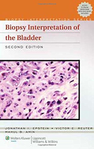 Biopsy Interpretation of the Bladder (Biopsy Interpretation Series) von Lippincott Williams & Wilkins