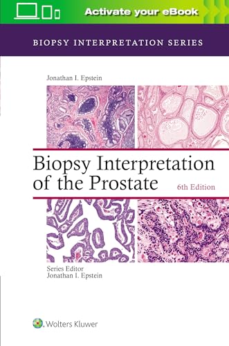 Biopsy Interpretation of the Prostate von LWW