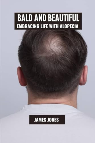 Bald and beautiful: Embracing life with alopecia von Independently published