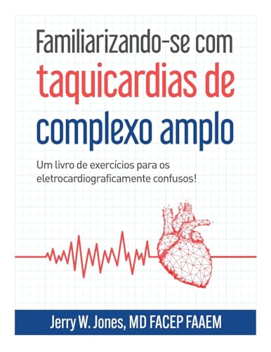 Familiarizando-se com Taquicardias de Complexo Largo: Um Caderno de Exercícios para os Confusos Eletrocardiograficamente! von Medicus of Houston