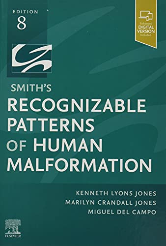 Smith's Recognizable Patterns of Human Malformation: Expert Consult - Online and Print von Elsevier