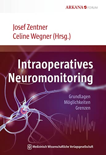 Intraoperatives Neuromonitoring: Grundlagen, Möglichkeiten, Grenzen
