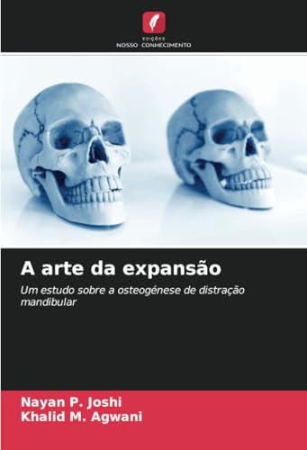 A arte da expansão: Um estudo sobre a osteogénese de distração mandibular von Edições Nosso Conhecimento