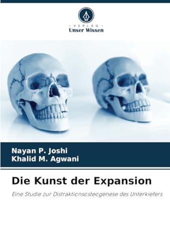 Die Kunst der Expansion: Eine Studie zur Distraktionsosteogenese des Unterkiefers von Verlag Unser Wissen