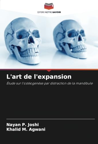 L'art de l'expansion: Étude sur l'ostéogenèse par distraction de la mandibule von Editions Notre Savoir
