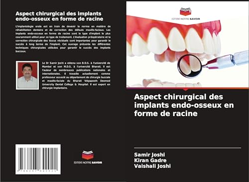 Aspect chirurgical des implants endo-osseux en forme de racine von Editions Notre Savoir
