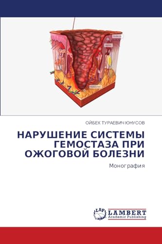 НАРУШЕНИЕ СИСТЕМЫ ГЕМОСТАЗА ПРИ ОЖОГОВОЙ БОЛЕЗНИ: Монография: Monografiq von LAP LAMBERT Academic Publishing