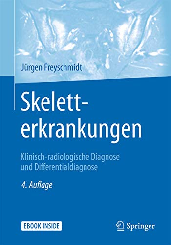 Skeletterkrankungen: Klinisch-radiologische Diagnose und Differentialdiagnose von Springer