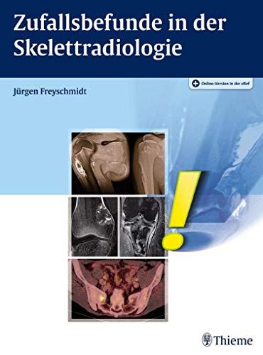Zufallsbefunde in der Skelettradiologie von Thieme, Stuttgart