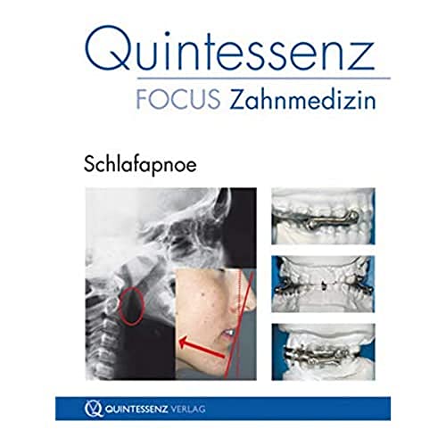 Quintessenz Focus Zahnmedizin: Schlafapnoe