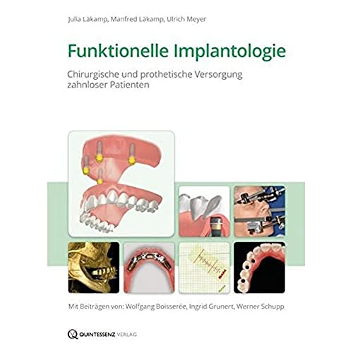 Funktionelle Implantologie: Chirurgische und prothetische Versorgung zahnloser Patienten