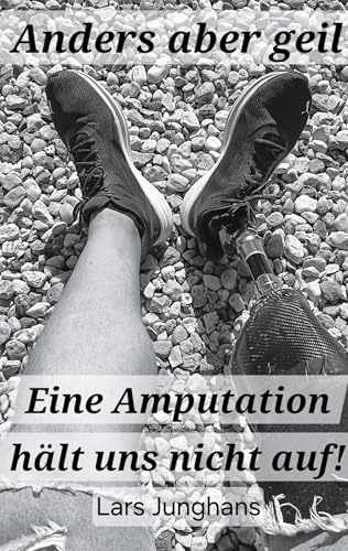 Anders aber geil: Eine Amputation hält uns nicht auf!