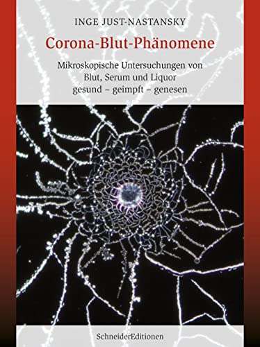 Corona-Blut-Phänomene: Mikroskopische Untersuchungen von Blut, Serum und Liquor gesund – geimpft – genesen Corona-Blut-Phänomene: Mikroskopische Untersuchungen von Blut, Serum und Liquor gesund – geimpft – genesen