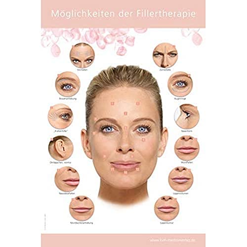 Poster Möglichkeiten der Fillertherapie Poster Möglichkeiten der Fillertherapie von KVM-Der Medizinverlag