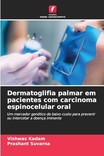 Dermatoglifia palmar em pacientes com carcinoma espinocelular oral: Um marcador genético de baixo custo para prevenir ou intercetar a doença iminente von Edições Nosso Conhecimento