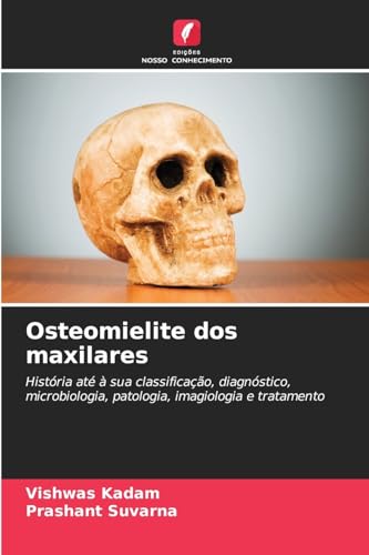 Osteomielite dos maxilares: História até à sua classificação, diagnóstico, microbiologia, patologia, imagiologia e tratamento von Edições Nosso Conhecimento