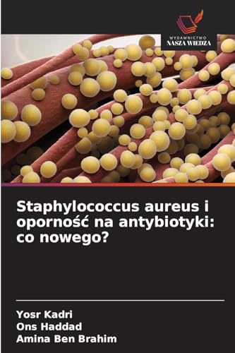 Staphylococcus aureus i oporno¿¿ na antybiotyki: co nowego?: DE von Wydawnictwo Nasza Wiedza
