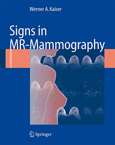 Signs in MR-Mammography von Springer