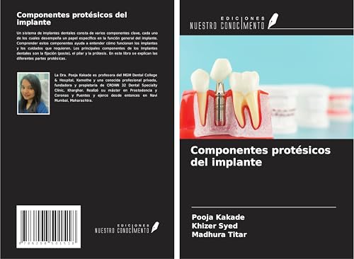 Componentes protésicos del implante von Ediciones Nuestro Conocimiento