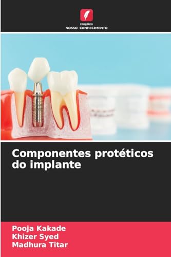 Componentes protéticos do implante von Edições Nosso Conhecimento