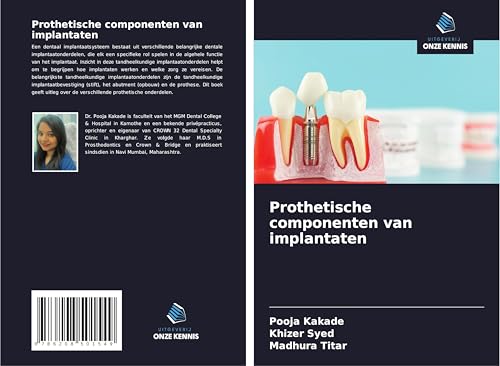 Prothetische componenten van implantaten von Uitgeverij Onze Kennis