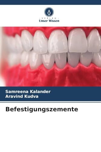 Befestigungszemente von Verlag Unser Wissen