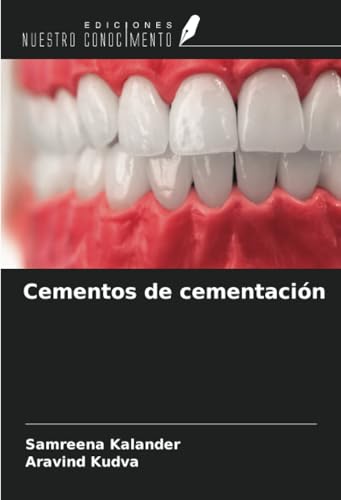 Cementos de cementación von Ediciones Nuestro Conocimiento