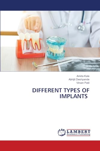 DIFFERENT TYPES OF IMPLANTS: DE