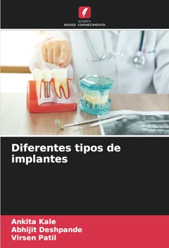 Diferentes tipos de implantes von Edições Nosso Conhecimento