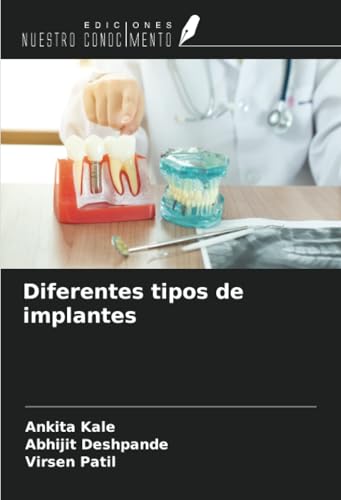Diferentes tipos de implantes von Ediciones Nuestro Conocimiento