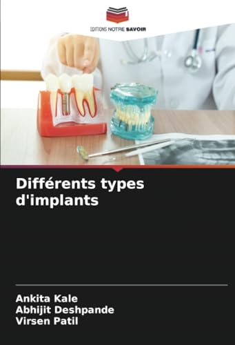 Différents types d'implants: DE von Editions Notre Savoir