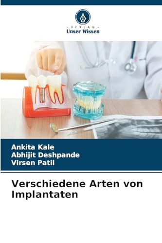 Verschiedene Arten von Implantaten von Verlag Unser Wissen