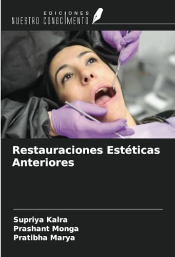 Restauraciones Estéticas Anteriores von Ediciones Nuestro Conocimiento