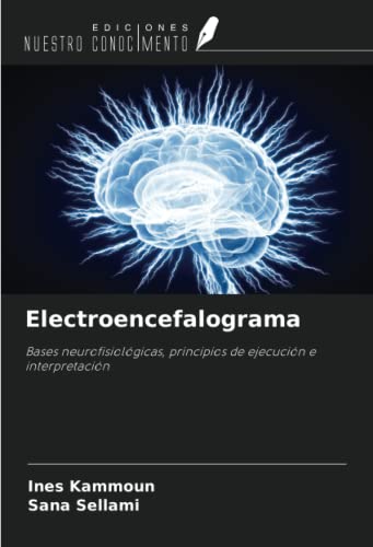 Electroencefalograma: Bases neurofisiológicas, principios de ejecución e interpretación von Ediciones Nuestro Conocimiento