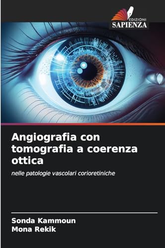 Angiografia con tomografia a coerenza ottica: nelle patologie vascolari corioretiniche von Edizioni Sapienza
