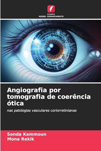 Angiografia por tomografia de coerência ótica: nas patologias vasculares coriorretinianas von Edições Nosso Conhecimento