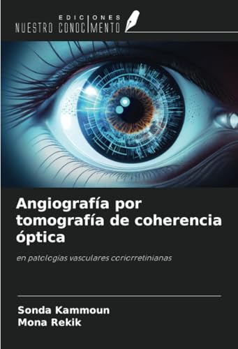 Angiografía por tomografía de coherencia óptica: en patologías vasculares coriorretinianas