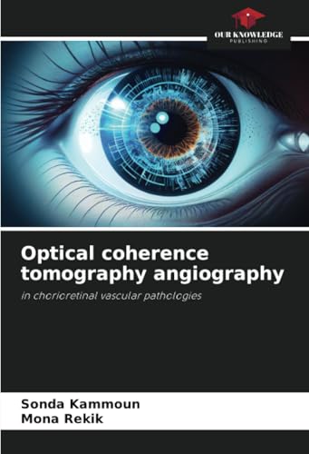 Optical coherence tomography angiography: in chorioretinal vascular pathologies von Our Knowledge Publishing