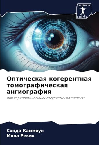 Оптическая когерентная томографическая ангиография: при хориоретинальных сосудистых патологиях: pri horioretinal'nyh sosudistyh patologiqh von Sciencia Scripts