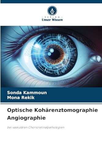Optische Kohärenztomographie Angiographie: bei vaskulären Chorioretinalpathologien von Verlag Unser Wissen