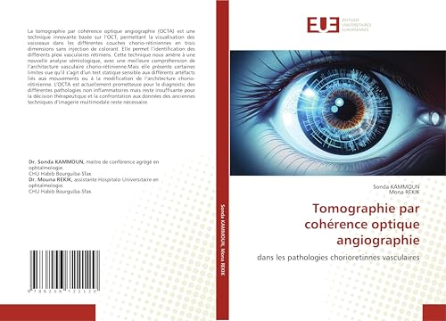 Tomographie par cohérence optique angiographie: dans les pathologies chorioretinnes vasculaires von Éditions universitaires européennes