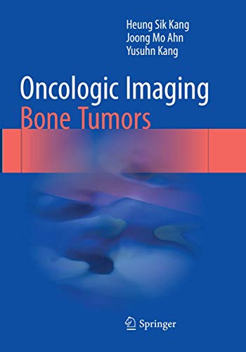 Oncologic Imaging: Bone Tumors von Springer